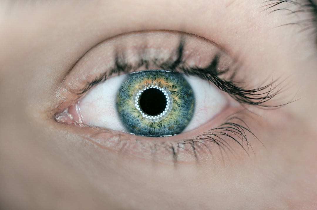 Laser Eye Surgery